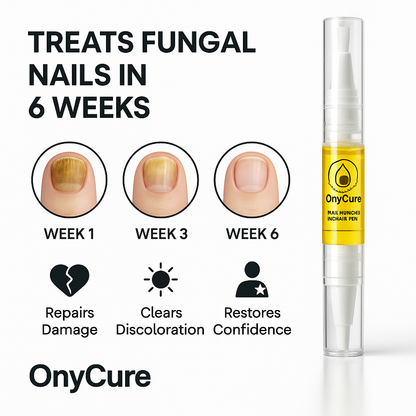OnyCure Pen™